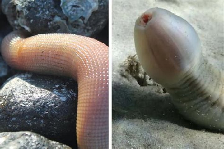 British Man Evades Death After Parasitic Worm Slithers Up His Penis
