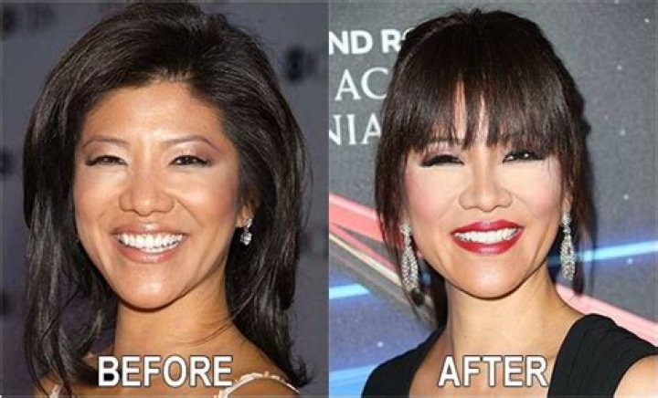 Julie Chen Plastic Surgery: Before and After, Nose Job, Eye Surgery