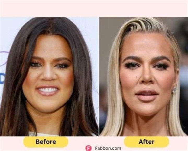 Plastic Surgery? Khloé Kardashian Looks Like a Completely Different Person in Recent Instagram Pic